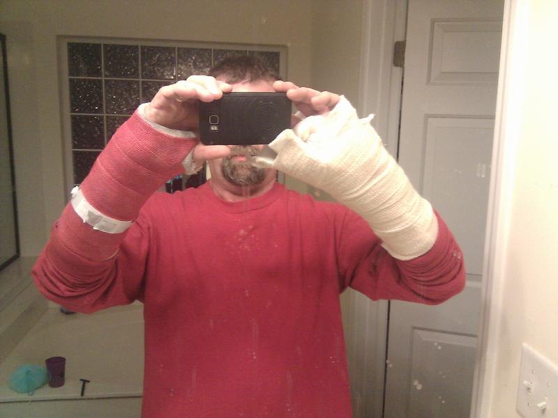 after first surgery after first surgery